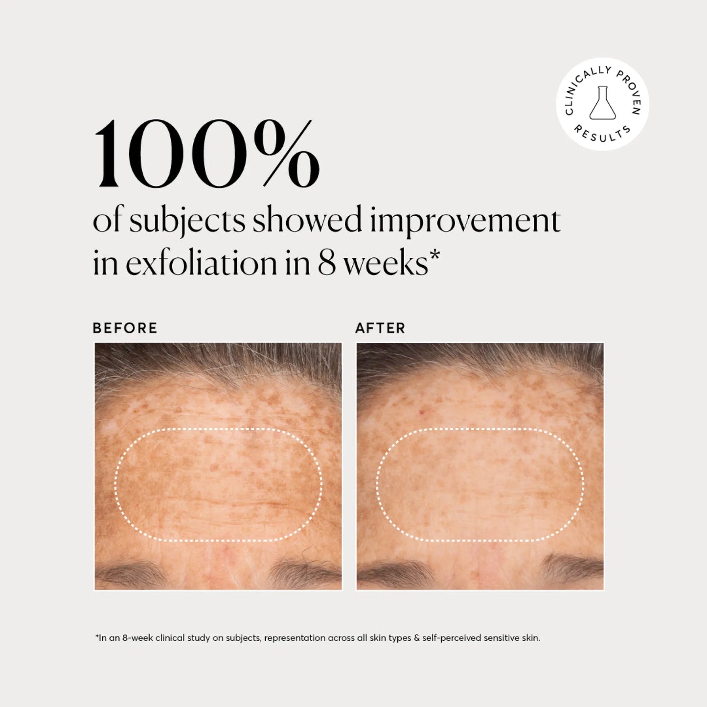 bha-liquid-exfoliant-2-z9 NATR-10027-Alt-Images-BHA-Liquid-Exfoliant-2_-03.webp